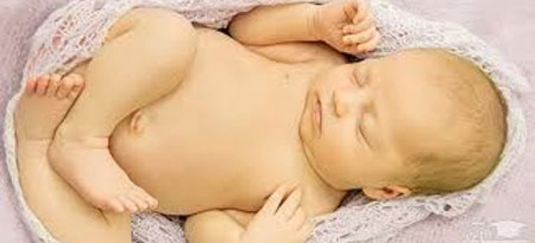 دستگاه یا روش سنتی برای درمان زردی نوزاد